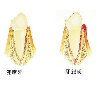 华体会官方-菲尼萨VCSEL出货量破3亿新工厂落成(图2) 华体会官方